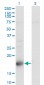 TSC22D1 Antibody (monoclonal) (M01)