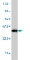 TSG101 Antibody (monoclonal) (M01)