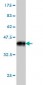 TSG101 Antibody (monoclonal) (M01)