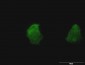 TSPAN8 Antibody (monoclonal) (M02)