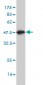 TSTA3 Antibody (monoclonal) (M01)