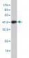 TSTA3 Antibody (monoclonal) (M01)