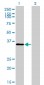 TSTA3 Antibody (monoclonal) (M01)