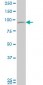 TTK Antibody (monoclonal) (M02)