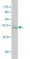 TTR Antibody (monoclonal) (M01)