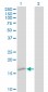 TTR Antibody (monoclonal) (M01)