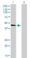 TUBA1 Antibody (monoclonal) (M01)