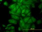 TUBA1 Antibody (monoclonal) (M01)