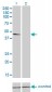 TUBA1 Antibody (monoclonal) (M01)