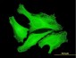 TUBA1 Antibody (monoclonal) (M04)