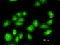 TUBA2 Antibody (monoclonal) (M01)