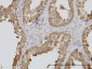 TUBA2 Antibody (monoclonal) (M01)