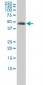 TUBA2 Antibody (monoclonal) (M01)