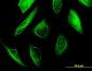 TUBA1A Antibody Monoclonal (M06)