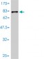 TUBA6 Antibody (monoclonal) (M01)