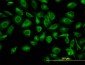 TUBA6 Antibody (monoclonal) (M04)