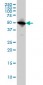 TUBA6 Antibody (monoclonal) (M04)