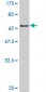 TUBB Antibody (monoclonal) (M04)