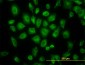 TUBB2 Antibody (monoclonal) (M02)