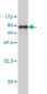 TUBB2 Antibody (monoclonal) (M02)