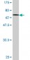 TUBB2A Antibody (monoclonal) (M03)