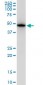 TUBB2A Antibody (monoclonal) (M03)