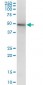 TUBB2A Antibody (monoclonal) (M03)