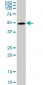 TUBB2A Antibody (monoclonal) (M03)