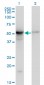 TUBB2A Antibody (monoclonal) (M03)