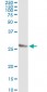 TWIST1 Antibody (monoclonal) (M01)