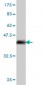 TWIST1 Antibody (monoclonal) (M01)