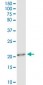 TWIST1 Antibody (monoclonal) (M01)