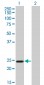 TWIST1 Antibody (monoclonal) (M01)