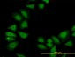 TXN Antibody (monoclonal) (M04)
