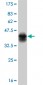 TYK2 Antibody (monoclonal) (M01)