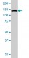 TYK2 Antibody (monoclonal) (M01)