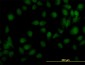 TYK2 Antibody (monoclonal) (M02)