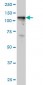 TYK2 Antibody (monoclonal) (M02)