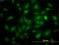 TYMS Antibody (monoclonal) (M01)