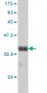 TYMS Antibody (monoclonal) (M01)