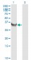 TYMS Antibody (monoclonal) (M01)