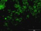 TYR Antibody (monoclonal) (M01)