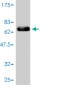 TYR Antibody (monoclonal) (M01)