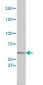 TYR Antibody (monoclonal) (M01)