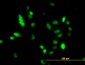 UBE2C Antibody (monoclonal) (M01)