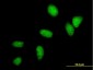 UBE2C Antibody (monoclonal) (M04)