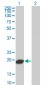 UBE2C Antibody (monoclonal) (M04)