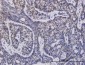 UBE2D1 Antibody (monoclonal) (M01)
