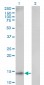 UBE2D1 Antibody (monoclonal) (M01)