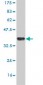 UBE2D2 Antibody (monoclonal) (M02)